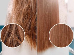 پروتئین تراپی