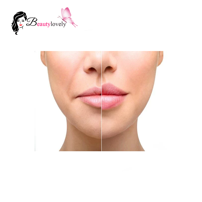 ویژگی های فیلر لب نیوویا مدل اینتنس لیپ